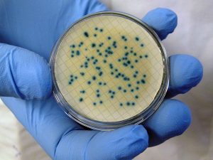 Harford, P.C. Files Food Poisoning Listeria Action in New York